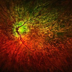 RICHARD EHRLICH - Retina, photograph, abstract