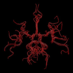 RICHARD EHRLICH - Red Circle of Willis, photograph, abstract